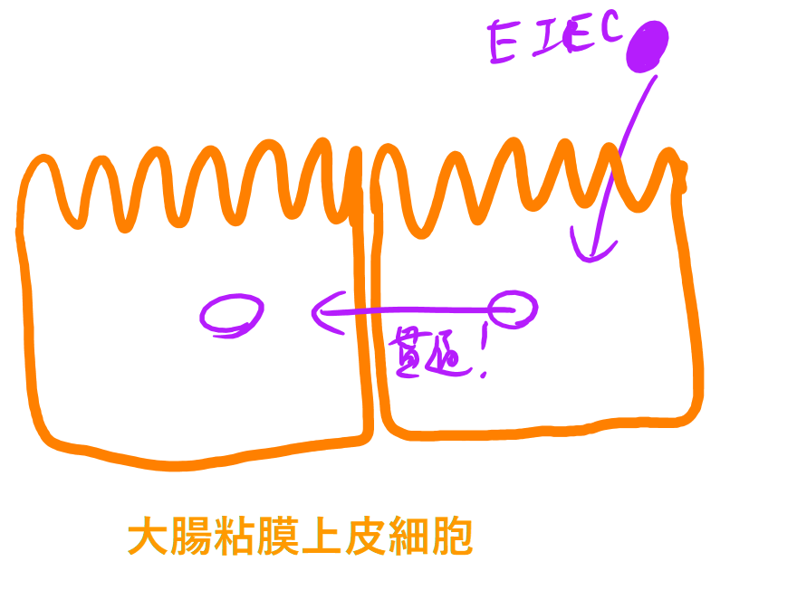 腸管侵入性大腸菌(EIEC)の侵入