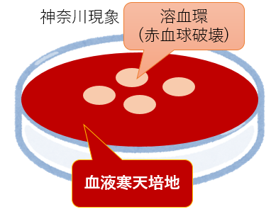 神奈川現象