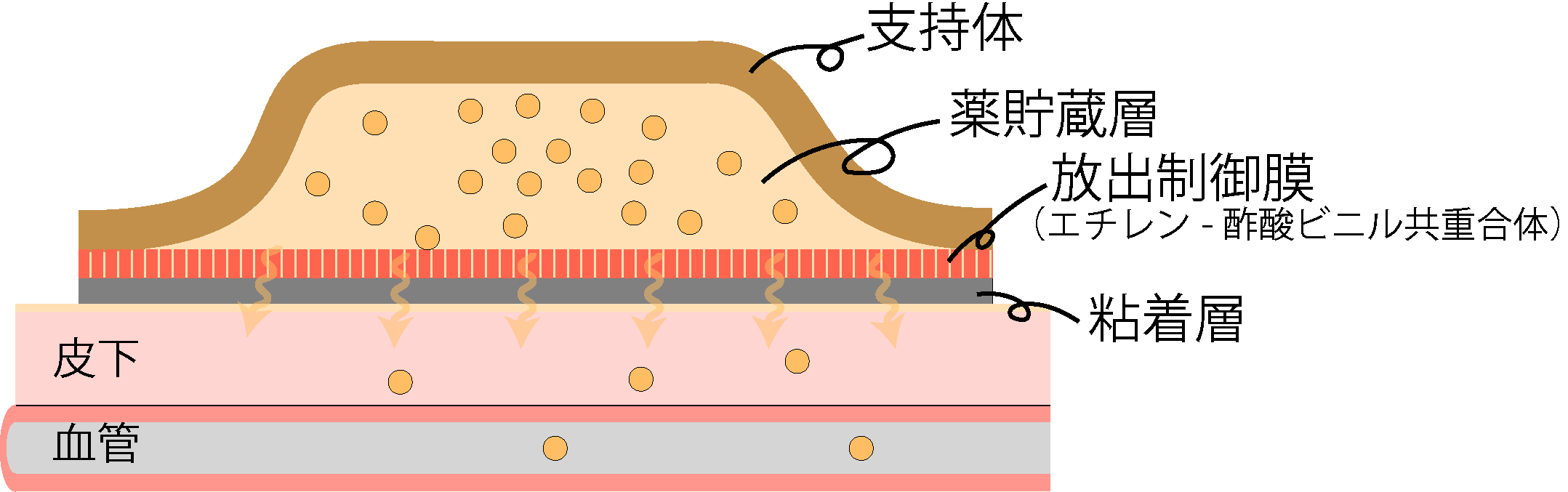 膜制御型
