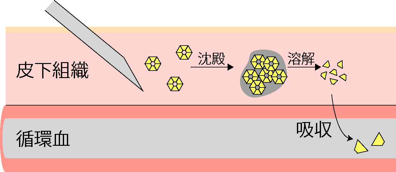 グラルギン